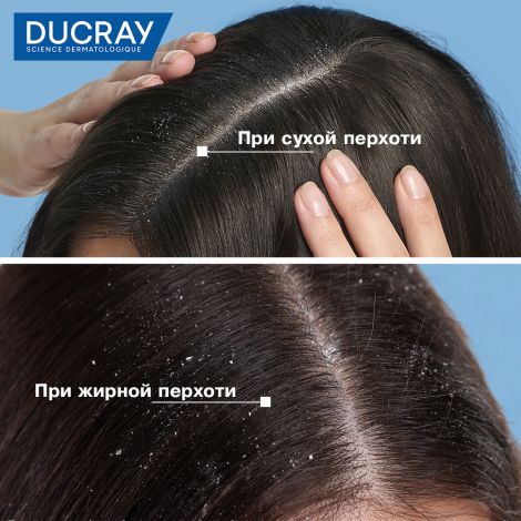 Дюкрэ Келюаль Скванорм лосьон от перхоти 200мл №6