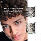 Виши Деркос сыворотка против перхоти интенсив. для кожи головы 90мл №3