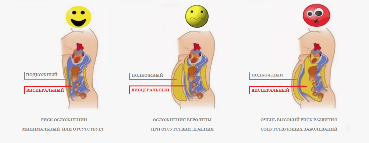 Какие уникальные лекарства для лечения ожирения создают в России