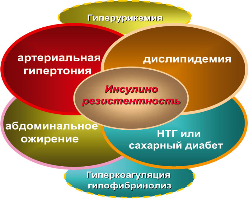 Ожирение при сахарном диабете. Заболевания метаболического синдрома. Метаболический синдром и инсулинорезистентность. Факторы метаболического синдрома. Причины развития метаболического синдрома.